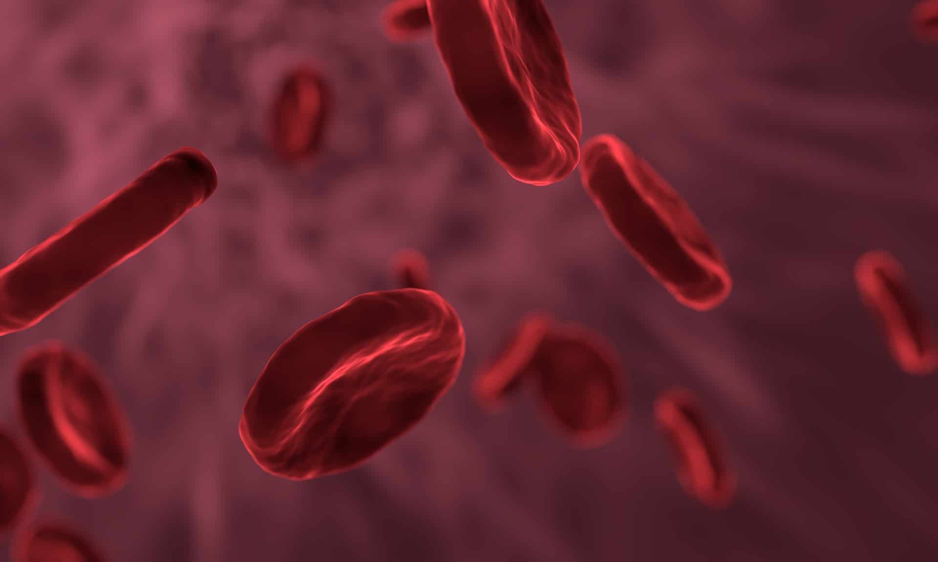 Sepsis and Medical Malpractice
